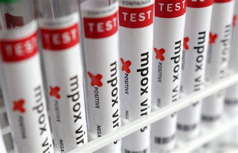 shukran diagnostics reviews|WHO invites makers of mpox tests for emergency review in push .